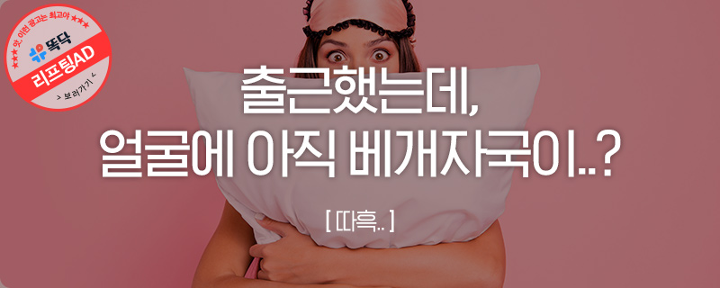 자국 생기면 한참 가는 사람들 드루와~~