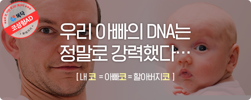 이전의 코는 내 것이 아니다.